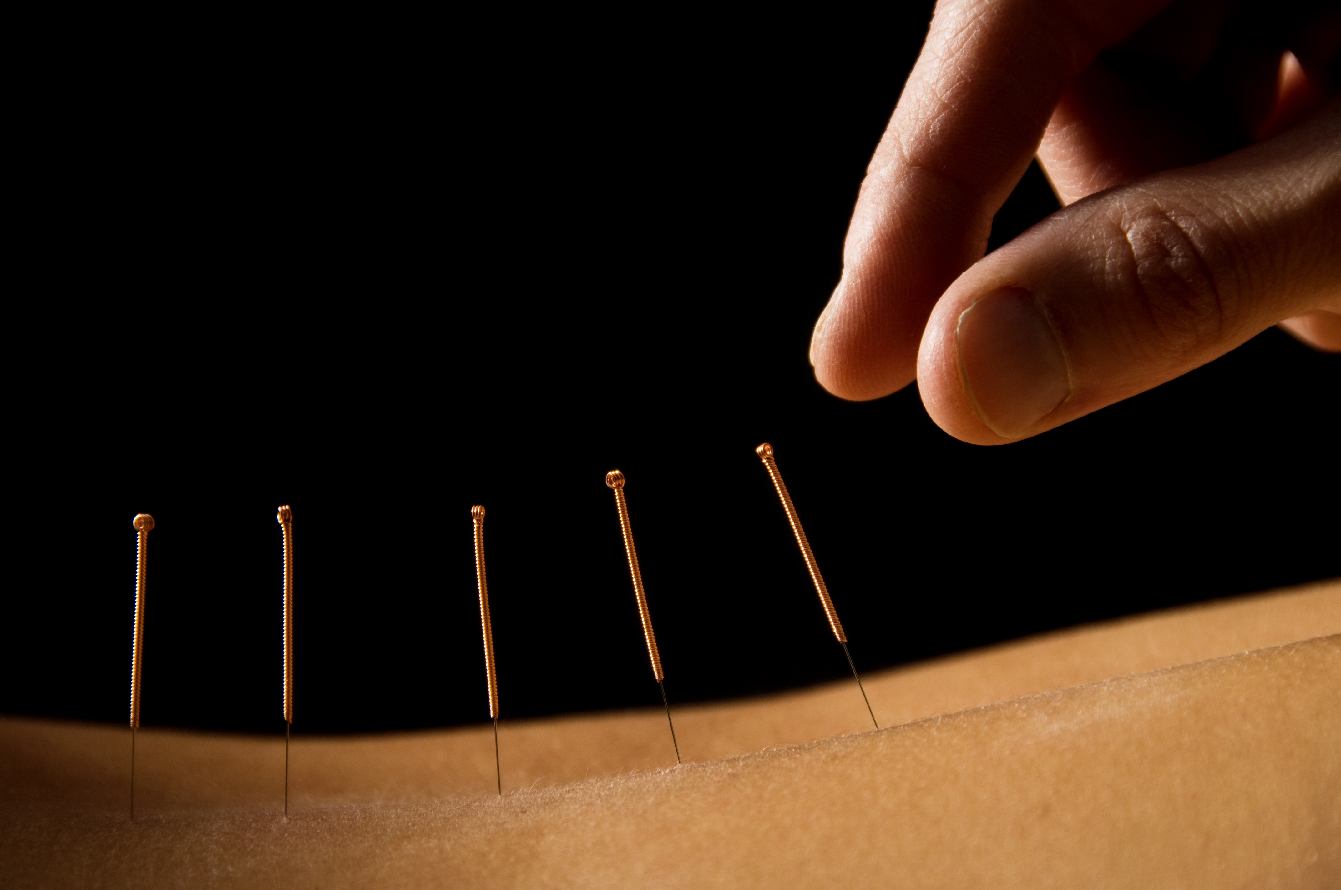 Acupuncture in Austin After Surgery