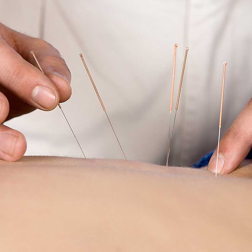 Austin acupuncture wellness pain relief photo